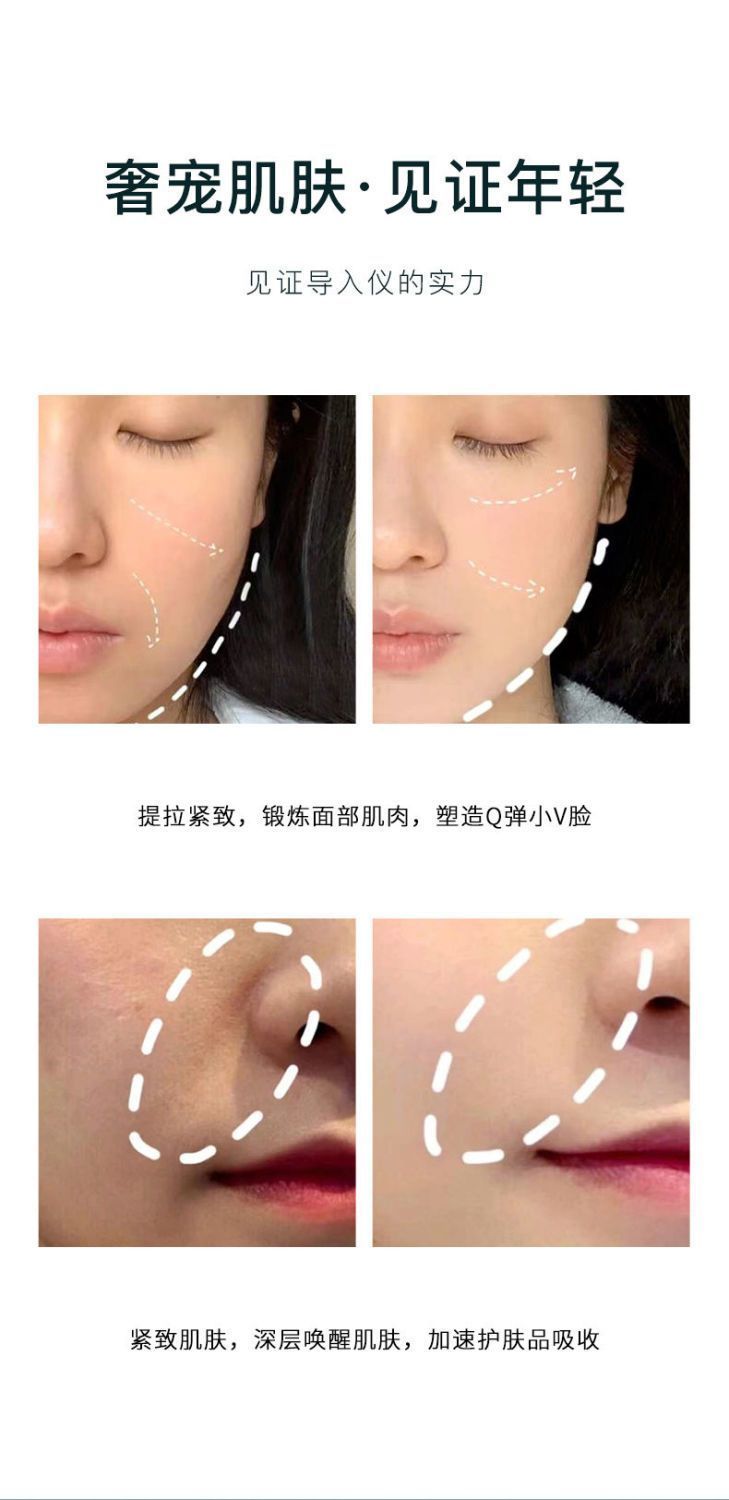 ADAD Beauty Electric Inductive Therapeutical Instrument Promote Skin Absorption Lift Forehead Lines Face Massage Instrument Vibration V Face Shaping